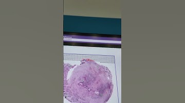 What happens in a whole slide scanner? (Hamamatsu S20)