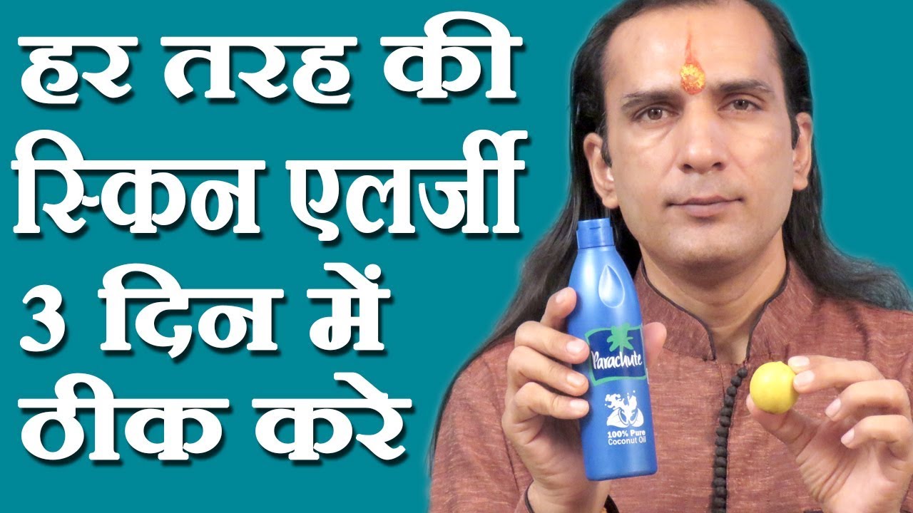 स्किन एलर्जी का घरेलू नुस्खा How To Cure Skin Allergy skin allergy