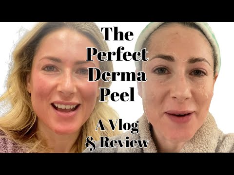 The Perfect Peel Vlog Is It Worth It MsGoldgirl