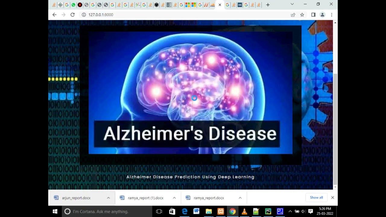 Alzheimer Disease Prediction Using Python Machine Learning - YouTube