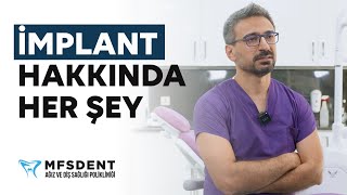 İmplant Hakkında Her Şey  | Dt. Mehmet Fatih Sever