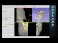 Tutorial: Preparing Data for 3D Printing Using 3D Slicer