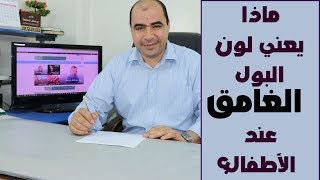 ماذا يدل لون البول الغامق عند الاطفال؟