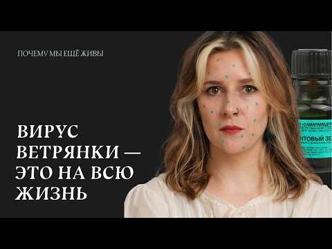Что мы знаем о вирусе ветряной оспы | Почему мы еще живы