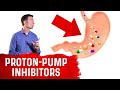 How Do Reflux Medications Work Proton Pump Inhibitors H2 Blockers Alginates