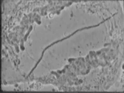 Video: Hva er de 18 stadiene av plantecelle mitose?