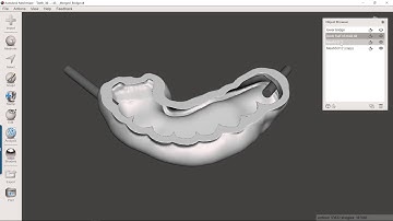 How to use Meshmixer to Fabricate a Mold for Creating a Temporary Prosthesis