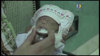 SNCU - Hand Expression of Breastmilk - Telugu