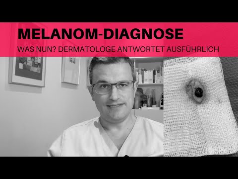 Video: Melanom - Ursachen, Symptome, Stadien Und Diagnose Von Melanomen