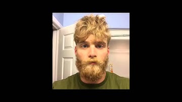 131 Day Beard Time Lapse
