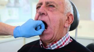 Finlay's patient with suction complete lower denture