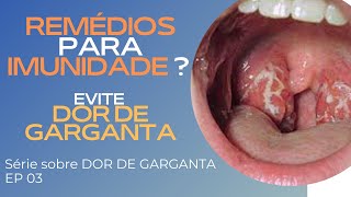 Pus na garganta, como identificar?