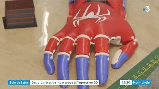 Mylann, 7 ans, découvre sa nouvelle main de super-héros, une prothèse imprimée en 3D