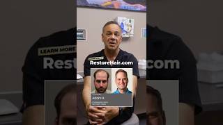 Are Hair Transplants Only for Celebrities? 🤔 Is FUE Right for You?