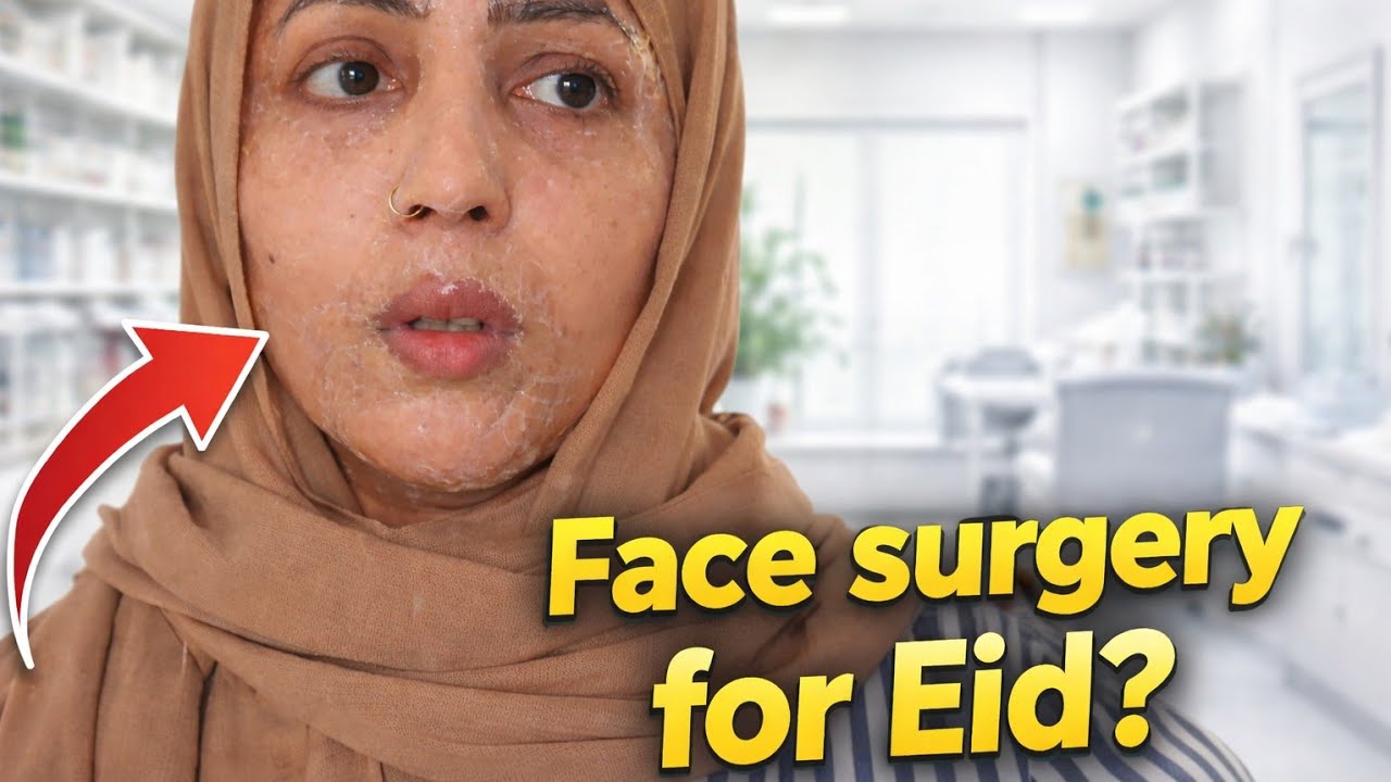 Face surgery for Eid || Face mask for Eid 2026 