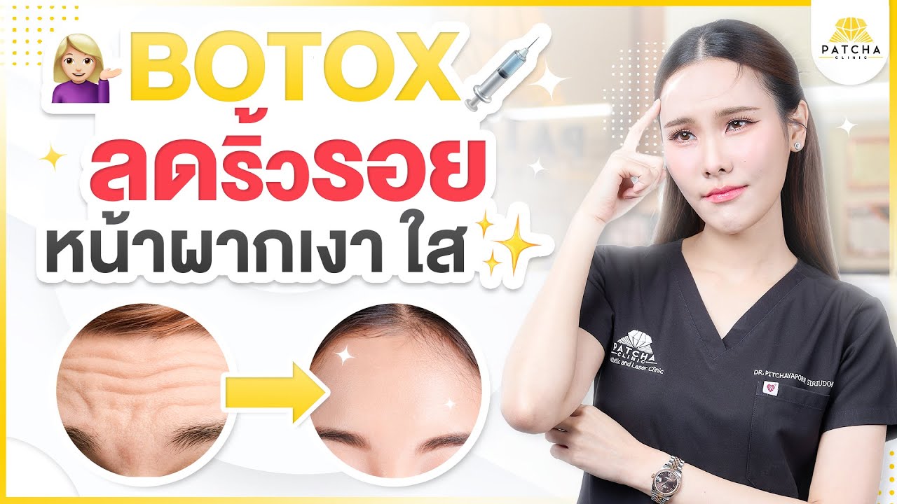 โบท็อกซ์หน้าผาก มีเทคนิคอย่างไร ต้องใช้กี่ยูนิต ต้องระวังผลข้างเคียงอะไรบ้าง