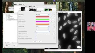 Identifying Speckles in CellProfiler - AskErinDearBeth Episode 7