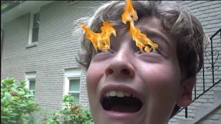 JACK GOES BLIND!!