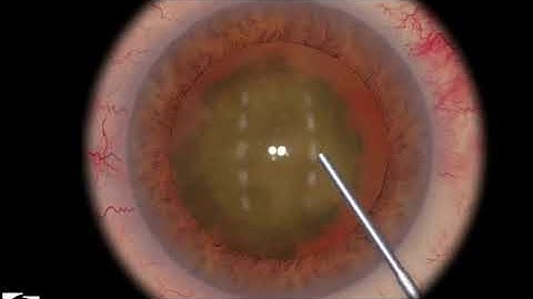 EyeSi CAT C Divide and Conquer Hydro Maneuvers, Level 6