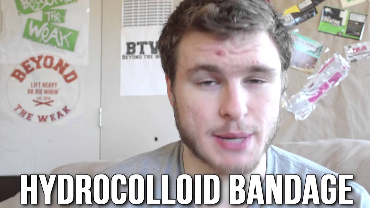 How To Deal With Cysts/Big Zits! YouTube