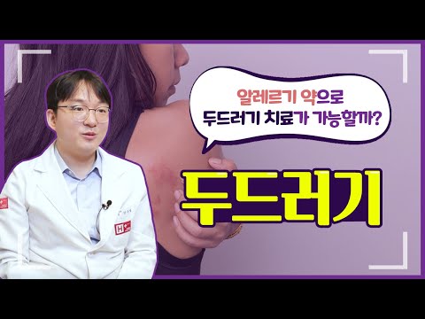 두드러기는 알레르기약으로 치료 가능할까?