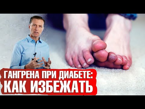 Гангрена при сахарном