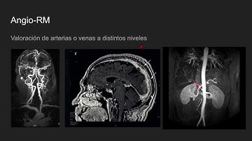 Introducción a la resonancia magnética