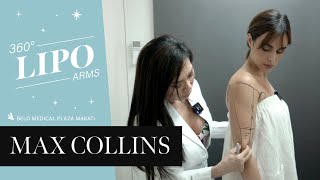 Max tries 360° Liposuction | Belo Medical Group by Belo Medical Group 18,492 views 10 months ago 1 minute, 12 seconds