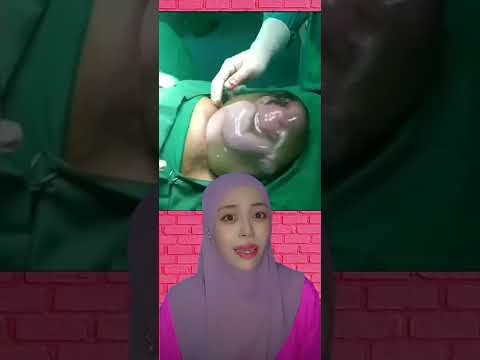 Video: Cara Menghentikan Tabiat Mengandung Anak (dengan Gambar)