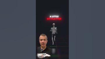 👟 Schedule a 3D gait analysis today! #runner #physicaltherapy #workout #sports #exercise