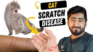 Cat Scratch fever || Bite wound treatment || Causes, Symptoms & Treatment || Animalia Dot Pk screenshot 5