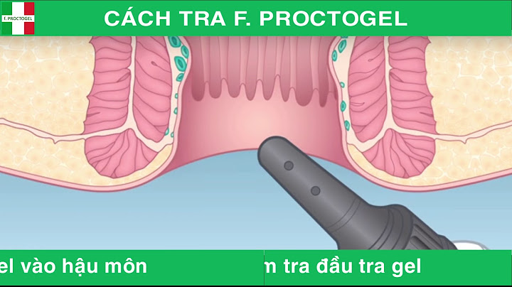 Hướng dẫn chơi lỗ hậu năm 2024