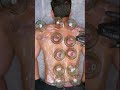 Fire cupping #relax #cupping #painrehabb #massagetherapy #trending #relaxing #massage #gym #trending