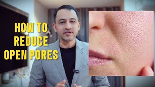ओपन पोर्स कसरी कम गर्ने? | How to reduce open pores