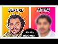 Keratin hair treatment  2023  my experience  full procedure explained  new vlog amit kochra