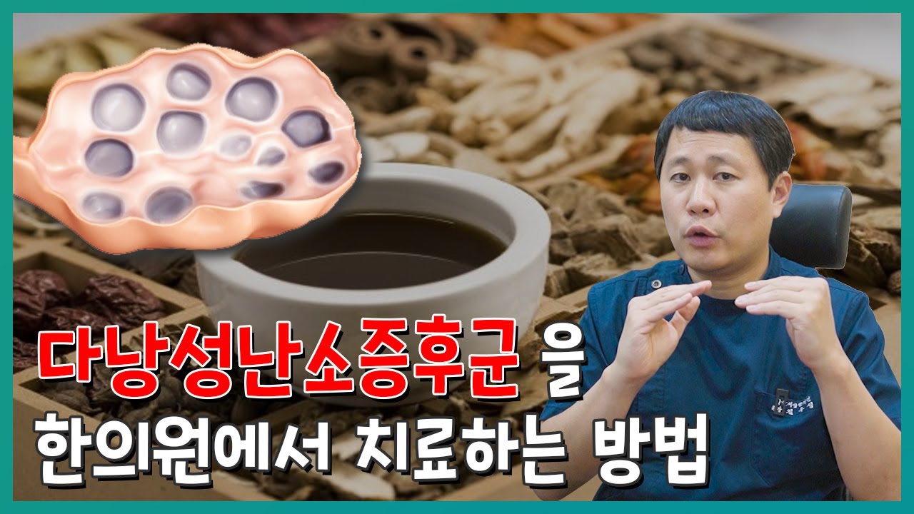 다낭성난소증후군 치료 한의원에서 하는 방법을 알려드립니다