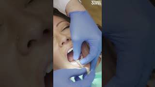 "Will getting my finals hurt?" 😖🦷😭 #3on6 #dentalimplants #smiletransformation