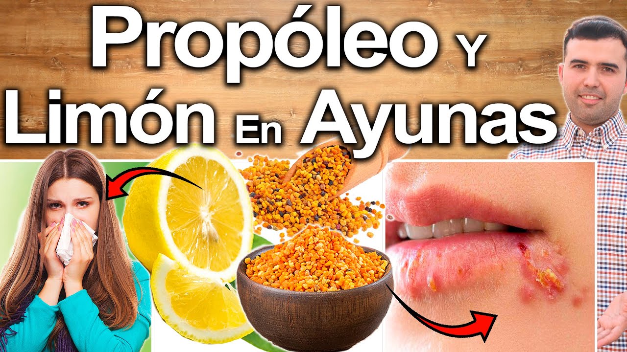 Prop�leo Y Lim�n Para Todo! - Para Qu� Sirve El Propoleo? - Beneficios Para Tu Salud Y Belleza