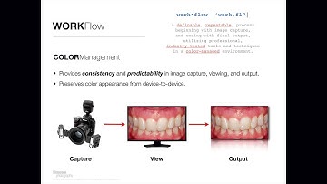 DentalCameraSystems-Intro