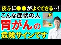 【まさか】放置すると後悔する、胃がんが隠れている意外な症状５つ　専門医が解説
