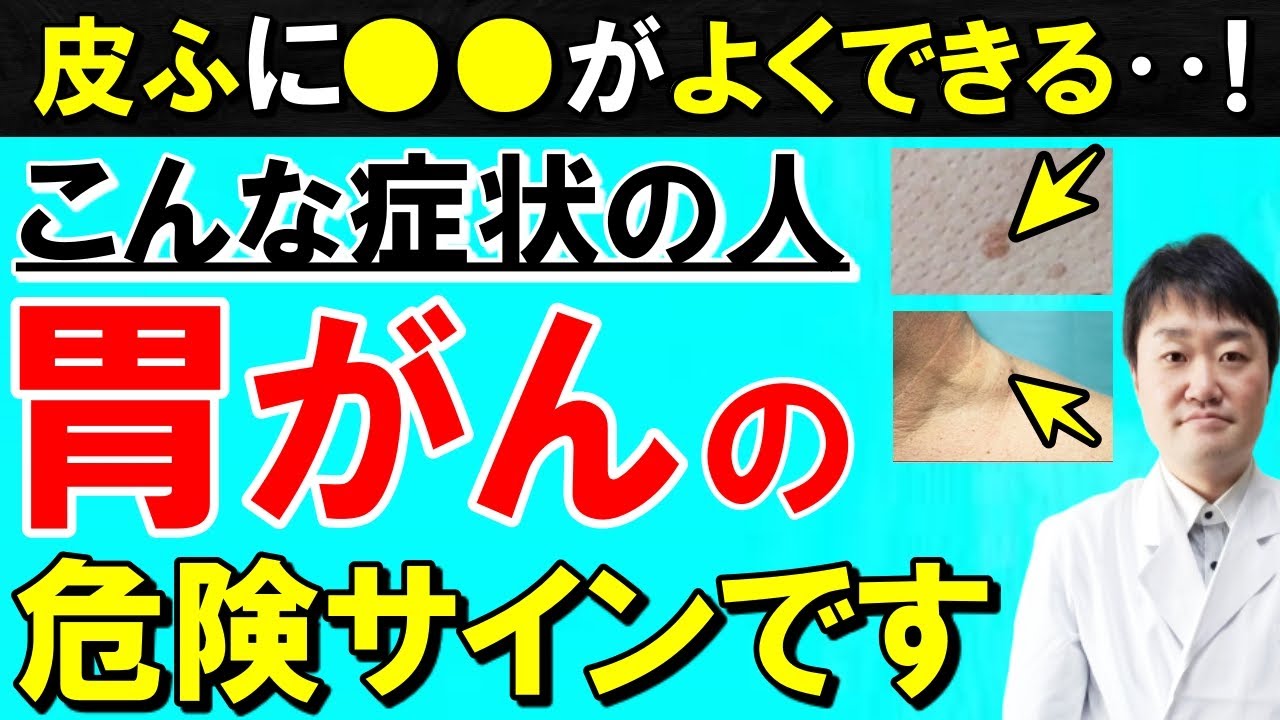 【まさか】放置すると後悔する、胃がんが隠れている意外な症状５つ　専門医が解説