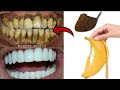 You won&#39;t believe! Teeth whitening and scaling in 1 minute|Get white teeth like pearls.