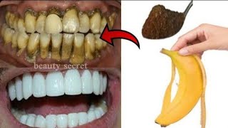 You won&#39;t believe! Teeth whitening and scaling in 1 minute|Get white teeth like pearls.