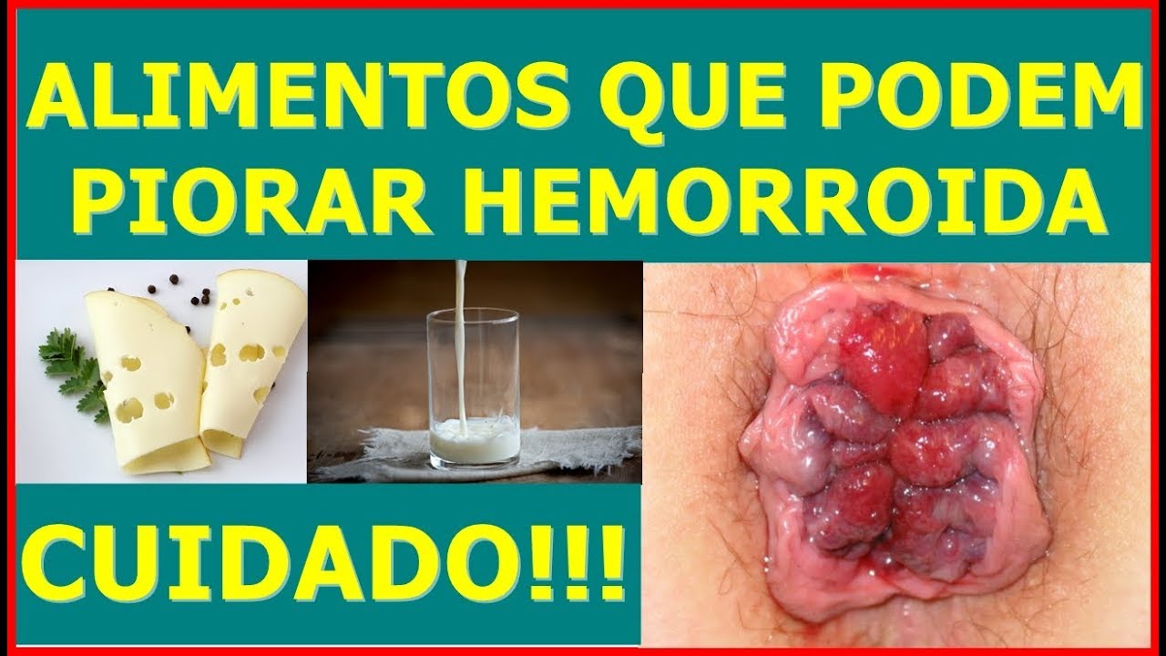 O Que Comer Para Desinflamar Hemorroidas