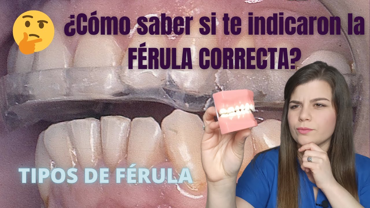 Cual es la MEJOR ferula de descarga dental en 2022 🦷🏆