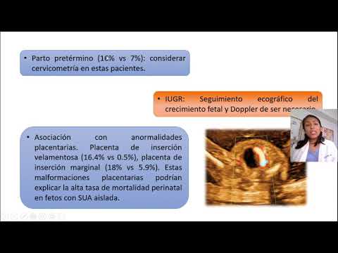 DOMINGO MÉDICO: Arteria Umbilical Única en Primer Trimestre