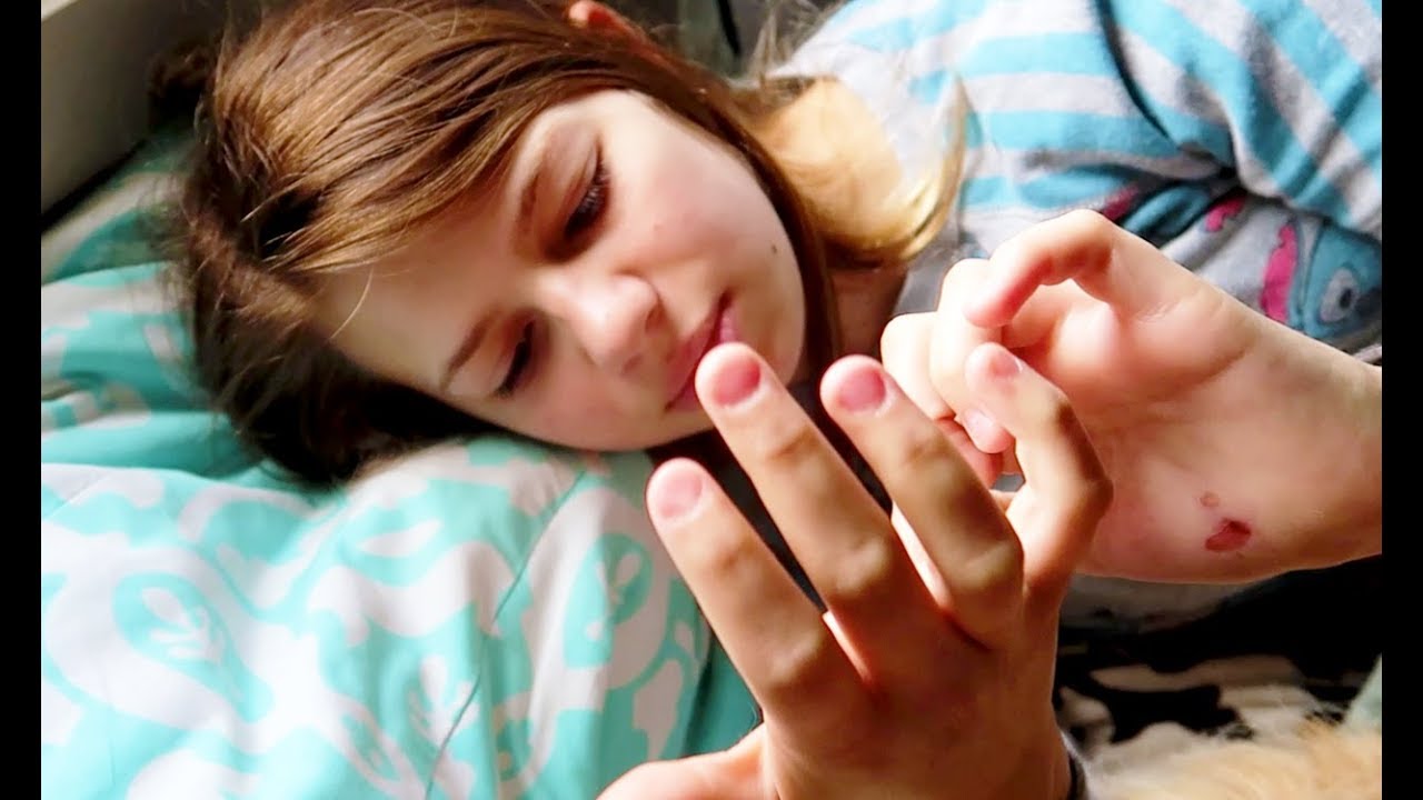 Update on Dog Bite and Full Story of What Happened!!