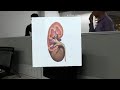 Hololens  kidney anatomy test 2