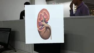 Hololens Kidney Anatomy Test 2