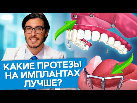 Video: Jauna Radioligandra Izstrāde 18 KD Translokatora Proteīna (TSPO) Attēlveidošanai Parkinsona Slimības žurku Modelī